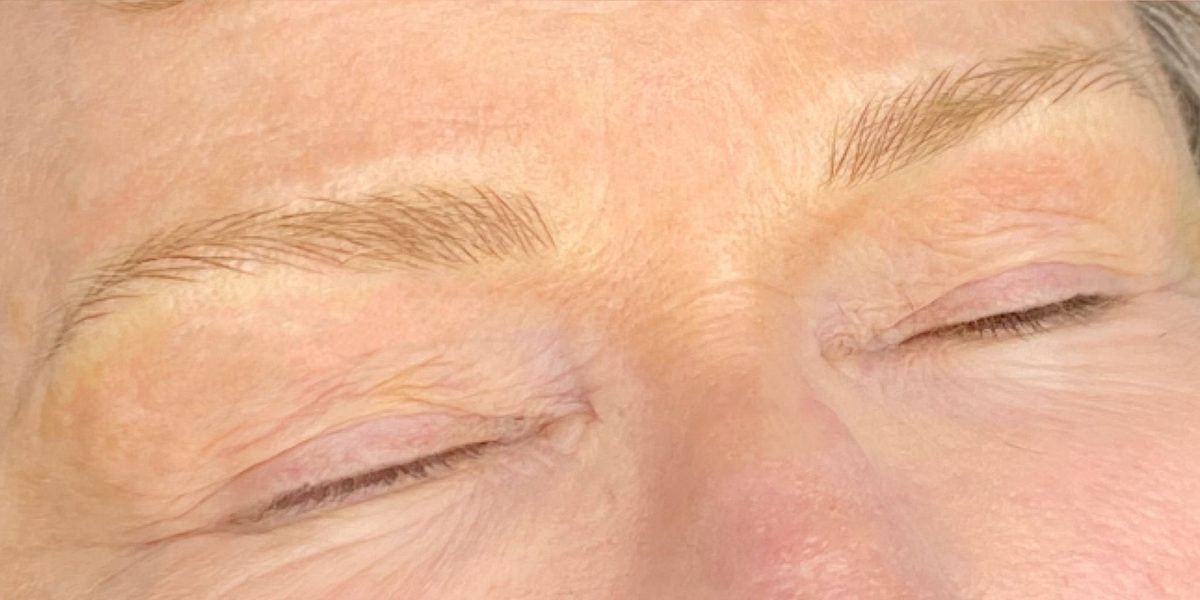 After Microblading