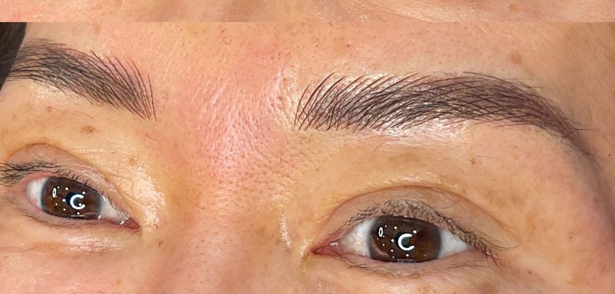 After Microblading